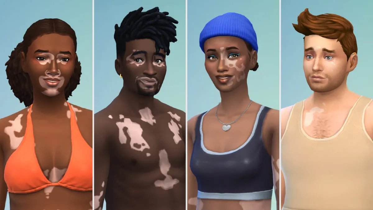 La última actualización gratuita de Sims 4 agrega la función de piel de vitíligo