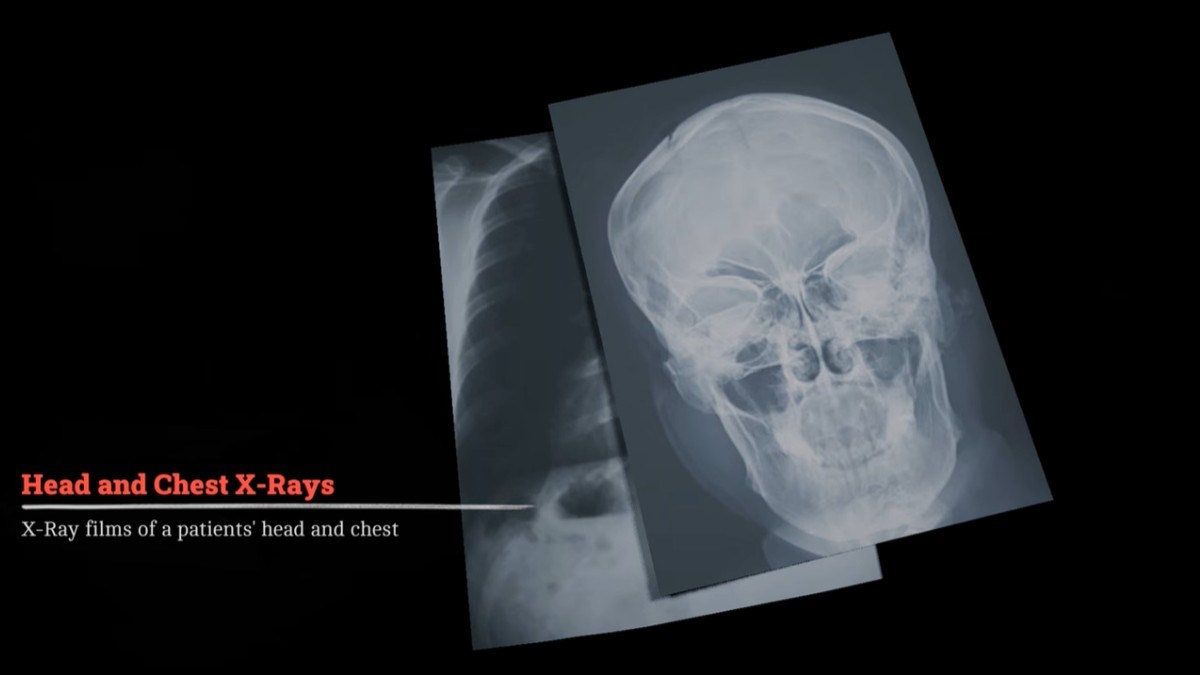 How to take x rays in Silent Hill Townfall